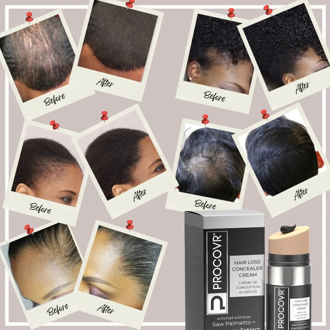 Hair Loss Concealer Cream - The ORIGINAL Thinning & Balding Hairline Enhancer, Hair Mascara for Natural Coverage & Thicker Appearance (Smoke Black FBA)