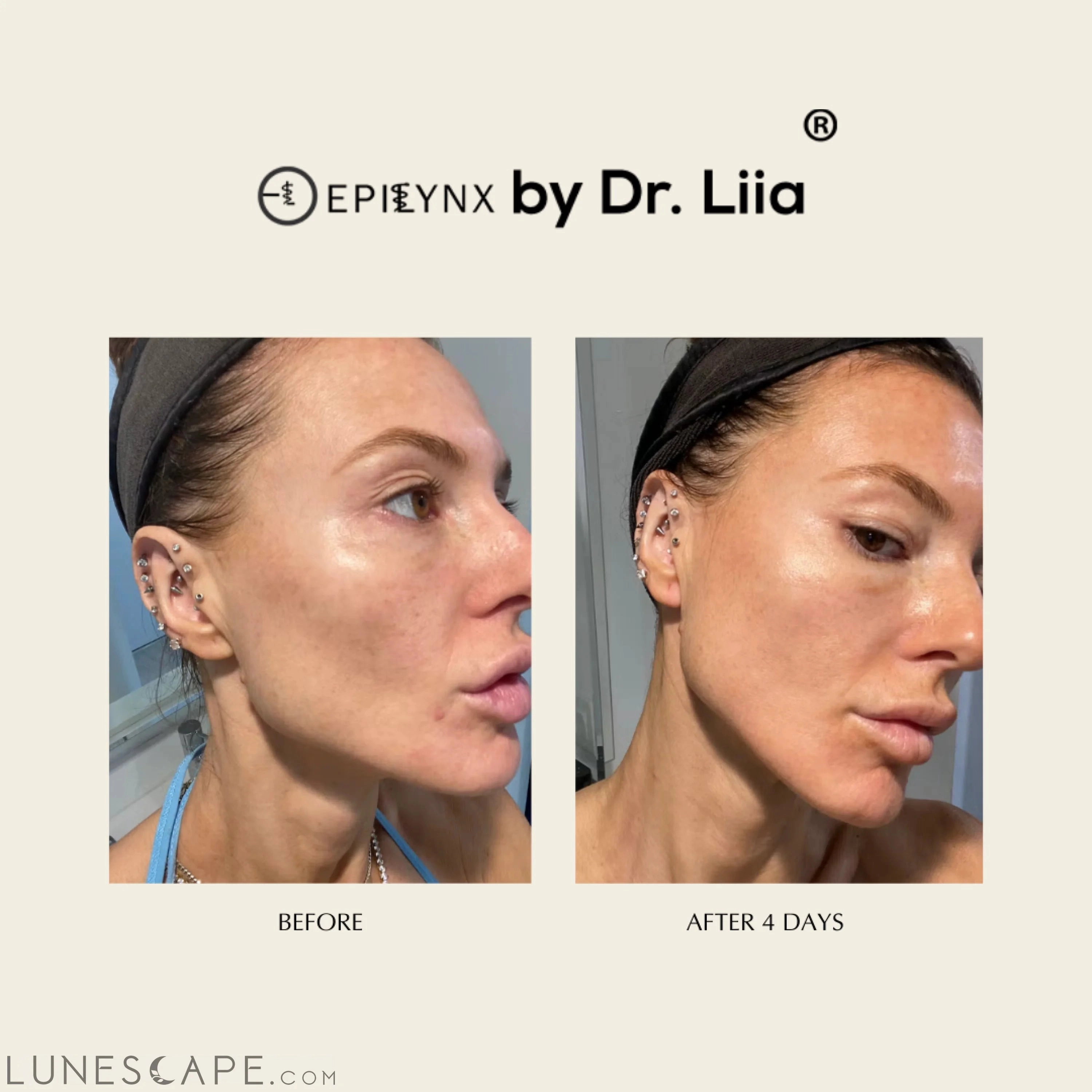 Illuminating Serum with Lactic and Salicylic Acid - Gentle